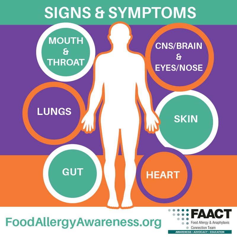 Anaphylaxis 